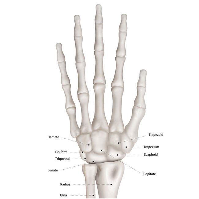 Broken or Sprained Wrist Diagram