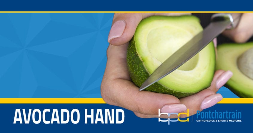 avocado hand