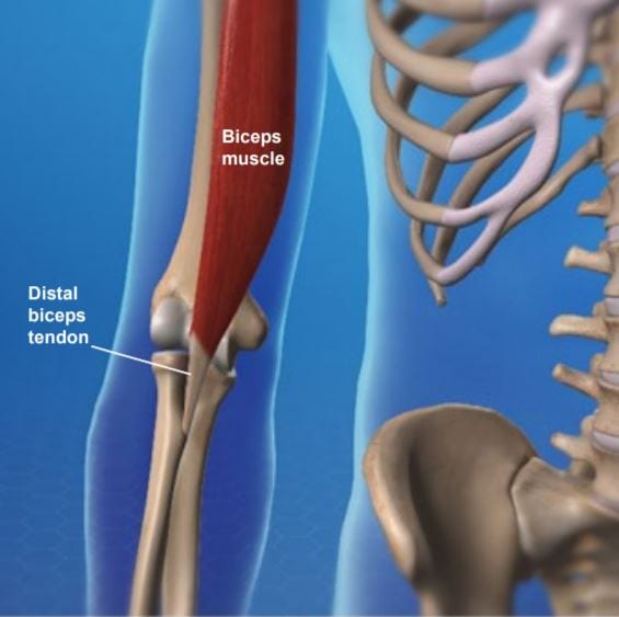 distal biceps tendon injury