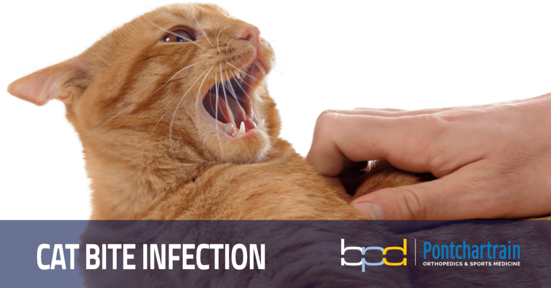 Cat Bite Infection Risk of Cat Bite to the Hand Brandon P. Donnelly, MD