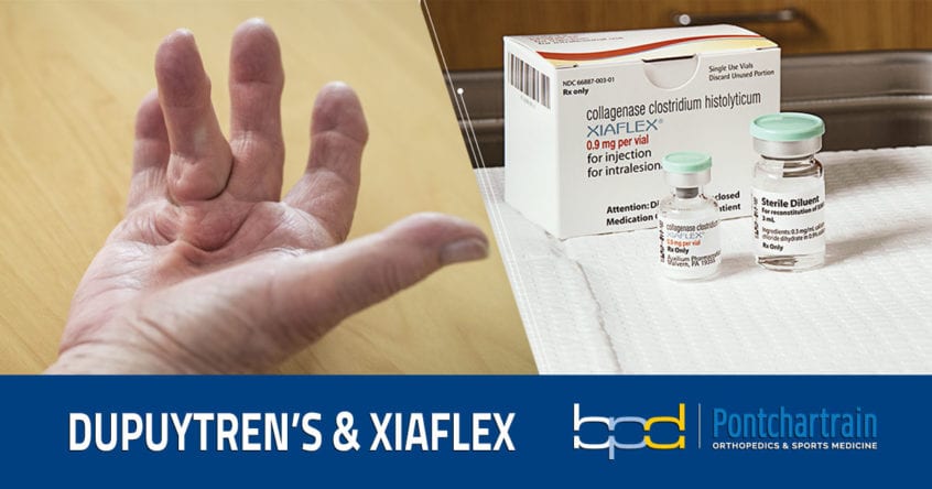 Treating Dupuytren’s Contractures with Xiaflex
