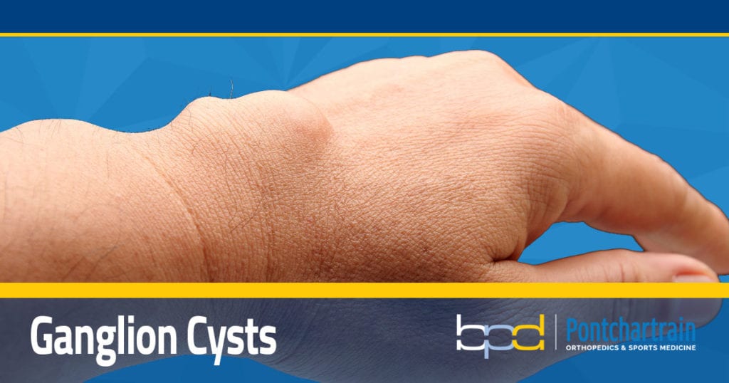 Ganglion Cyst Wrist Pain