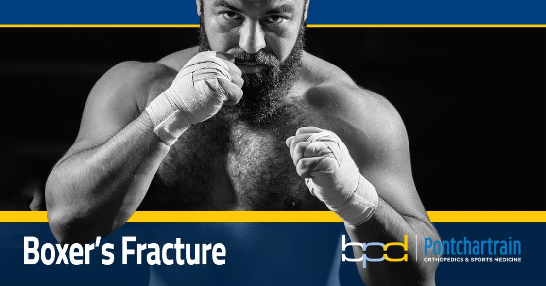 Boxer's Fracture Hand Specialist Brandon P. Donnelly, MD