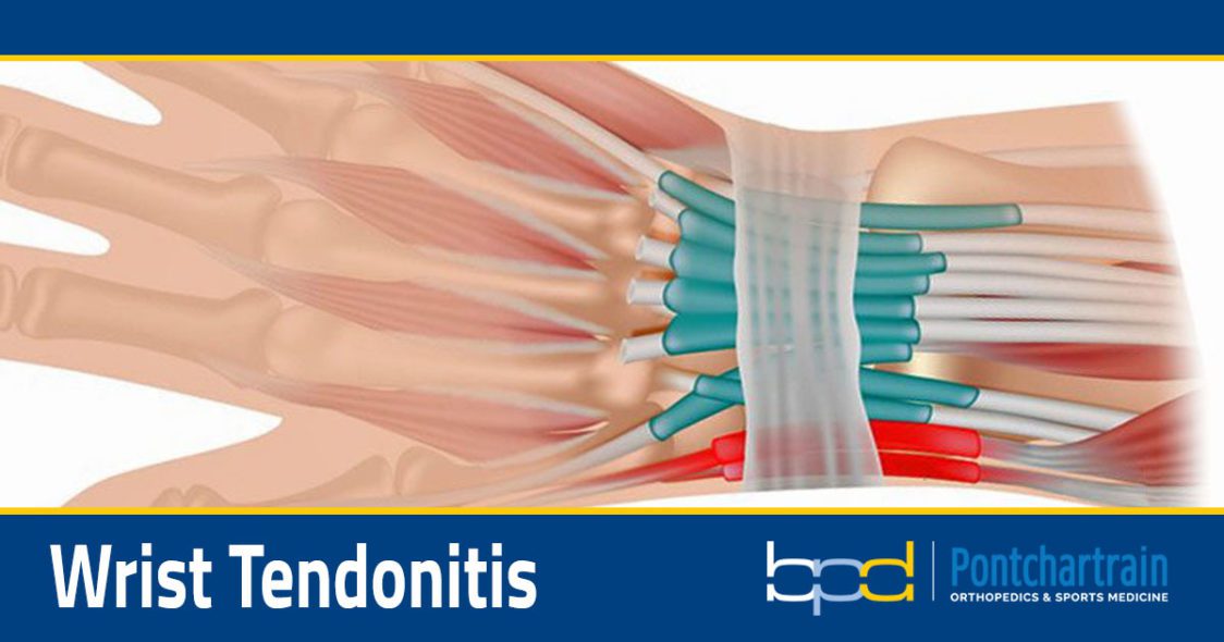 Wrist Tendonitis - Brandon P. Donnelly, MD